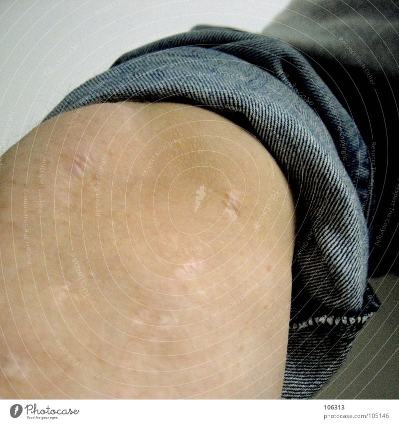 TRAUMBERUF FLIESENLEGER maskulin Körper Haut Beine authentisch Gesundheit kaputt rebellisch Wade Nackte Haut Narbe Bildausschnitt Anschnitt Hosenbeine Operation