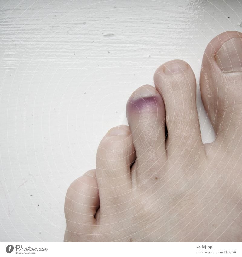 kollateralschaden Zehen Zehennagel gebrochen 5 unaufmerksam Fehler Beule Unfall Barfuß violett Bluterguss Prellung Mensch Wut Ärger Fuß stolpern Tanz in den Mai