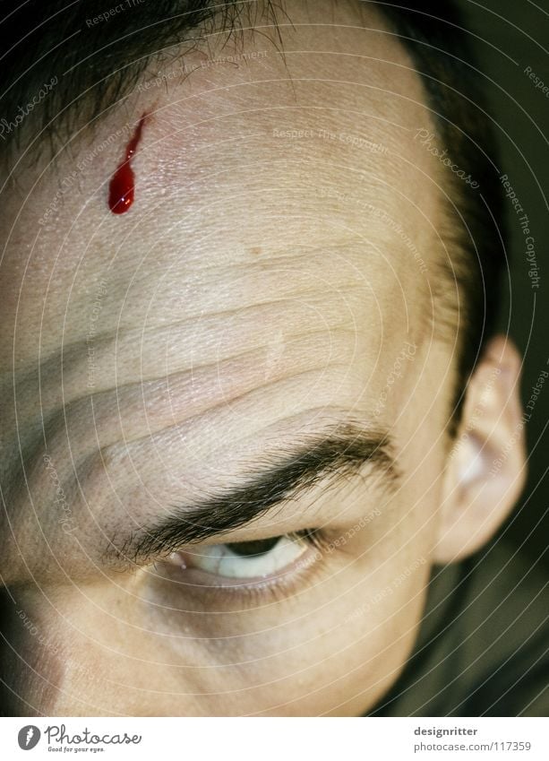 Migräne Stirn verletzen Wunde Blut Kratzer Schnittwunde geschnitten Kopfschmerzen Wut Ärger gefährlich Aggression Täter Reaktionen u. Effekte Antwort