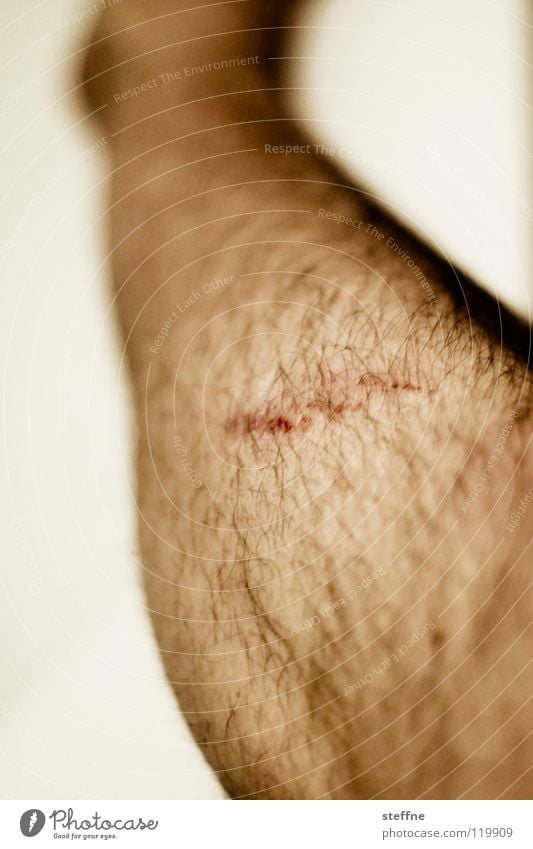 Auaweh! Wunde Kratzer Schürfwunde Mann Mensch Beine Schürfung Schramme Männerbein Detailaufnahme Bildausschnitt Heilung Behaarung