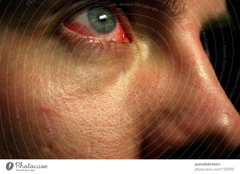 Philippe - pinkeye Gesicht Krankheit Gesundheitswesen Mensch Mann Erwachsene Auge dunkel gruselig rot Reinlichkeit Sauberkeit Schmerz Angst Blut Konjunktivitis
