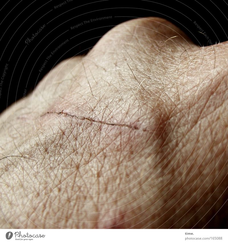 Lebenslinien #08 Haut Hand rund Narbe Handknöchel Kruste Heilung Gefäße Schramme Kratzer Behaarung Pore Freisteller Vor dunklem Hintergrund Anschnitt