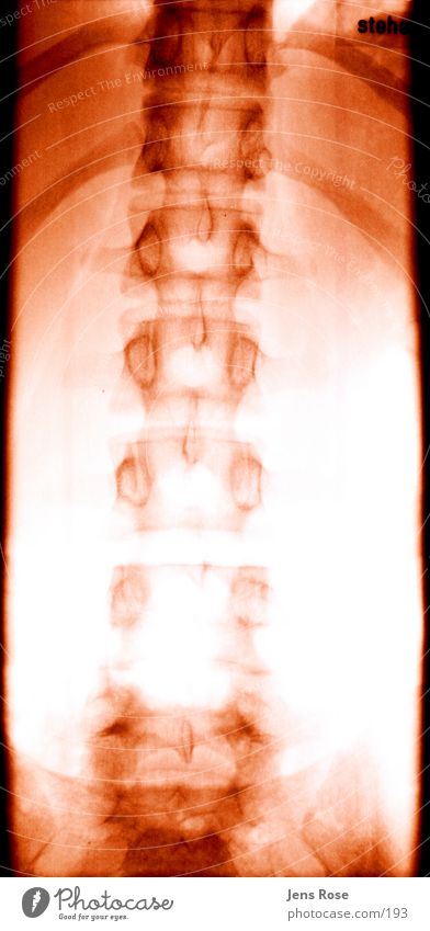 röntgen01 Skelett Strahlung Mensch Rücken Radiologie
