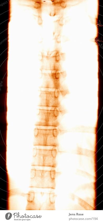 röntgen02 Skelett Strahlung Mensch Rücken Radiologie