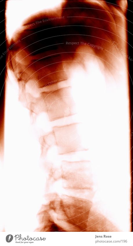röntgen04 Skelett Strahlung Mensch Rücken Radiologie