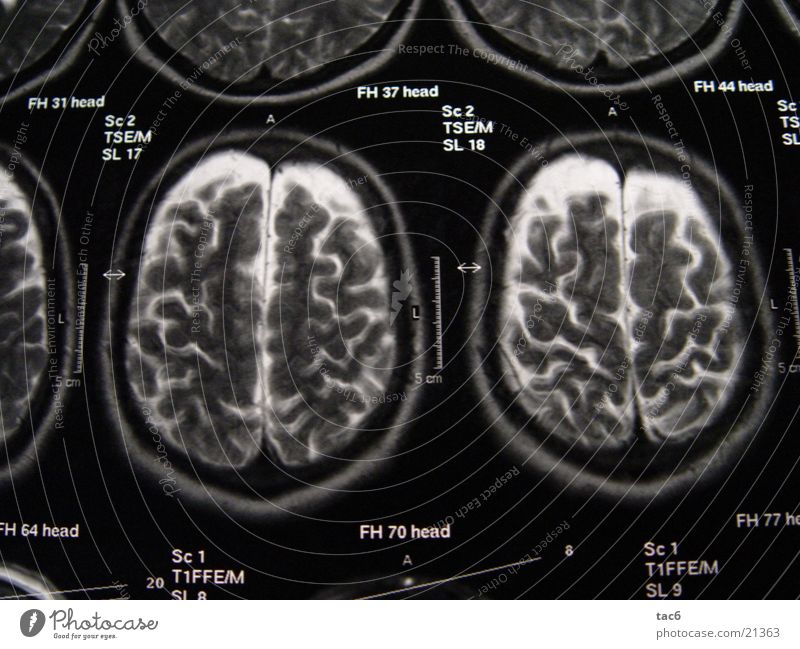 Kernspinserie Nr.4 Gehirn u. Nerven Elektrisches Gerät Technik & Technologie Schädel durchleuchten Kopf Fotografie Kernspintomographie Diagnostik Röntgenbild