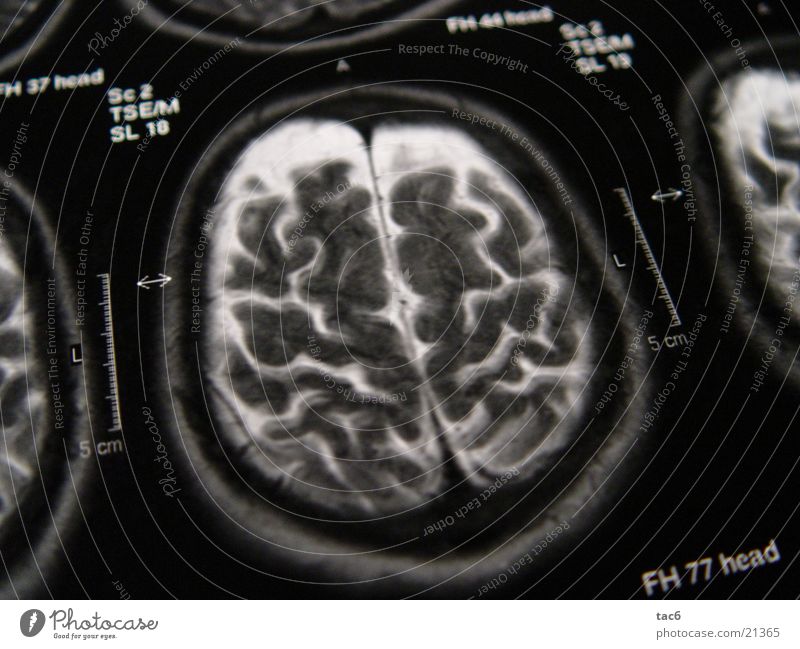 Kernspinserie Nr.3 Gehirn u. Nerven Elektrisches Gerät Technik & Technologie Schädel durchleuchten Kopf Fotografie Kernspintomographie Diagnostik Röntgenbild