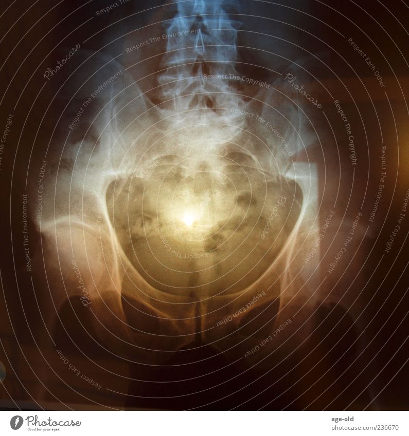 X-ray on sunset Mann Erwachsene Hüfte blau braun gelb schwarz bizarr Röntgenbild Sonnenlicht Sonnenuntergang Radiologie Farbfoto Außenaufnahme Experiment Abend