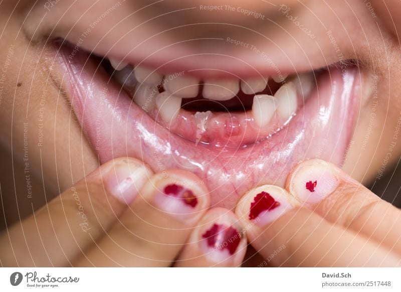 Zahnlücke Gesundheit Mensch Kind Mädchen Mund Lippen Zähne Finger 1 3-8 Jahre Kindheit festhalten braun orange rot Freude Begeisterung selbstbewußt Stolz