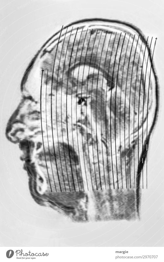UT Kassel | Kopf Arzt Gesundheitswesen Technik & Technologie Mensch maskulin feminin androgyn Frau Erwachsene Mann Gesicht Nase Mund schwarz weiß Röntgenbild