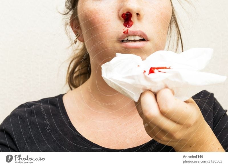 Wunde Nasenbluten, Frau blutet aus der Nase. Körper Haut Gesicht Gesundheitswesen Krankheit Medikament Erholung Mensch Erwachsene Mund Tropfen klein rot weiß