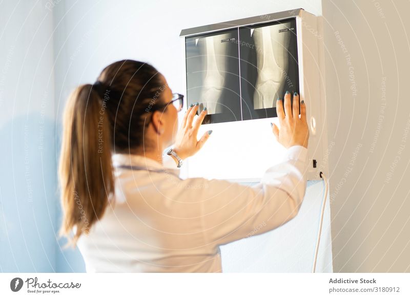 Junger Arzt mit Röntgenfilmdokument an der Wand Medikament Radiologie Uniform Filmmaterial Bild Raum Frau Blick Jugendliche Röntgenaufnahme Scan Chirurg