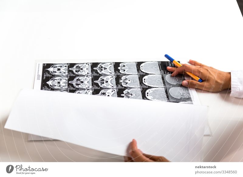 CT-Scans auf dem Schreibtisch und an den Händen des Arztes Frau Erwachsene Hand anstrengen Gesundheit Gesundheitswesen innovativ ct-Scan Radiologie Bild
