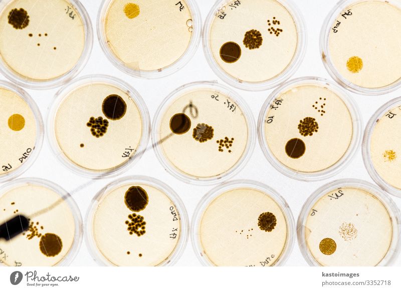 Wachsende Bakterien in Petrischalen. Teller Gesundheitswesen Medikament Wissenschaften Labor Technik & Technologie Kultur Reinigen Wachstum anstrengen Agar