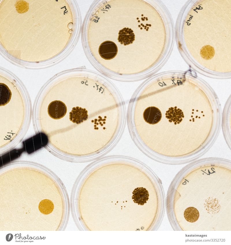 Wachsende Bakterien in Petrischalen. Teller Gesundheitswesen Medikament Wissenschaften Labor Technik & Technologie Kultur Reinigen Wachstum anstrengen