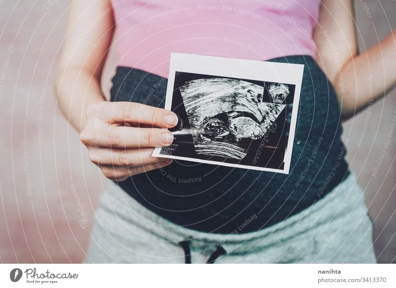 Frau, die den Ultraschall ihres Babys hält schwanger Schwangerschaft Mama Familie Sekunde Stadtteil Trimester Monat 20 Wochen Gesundheit medizinisch Behandlung