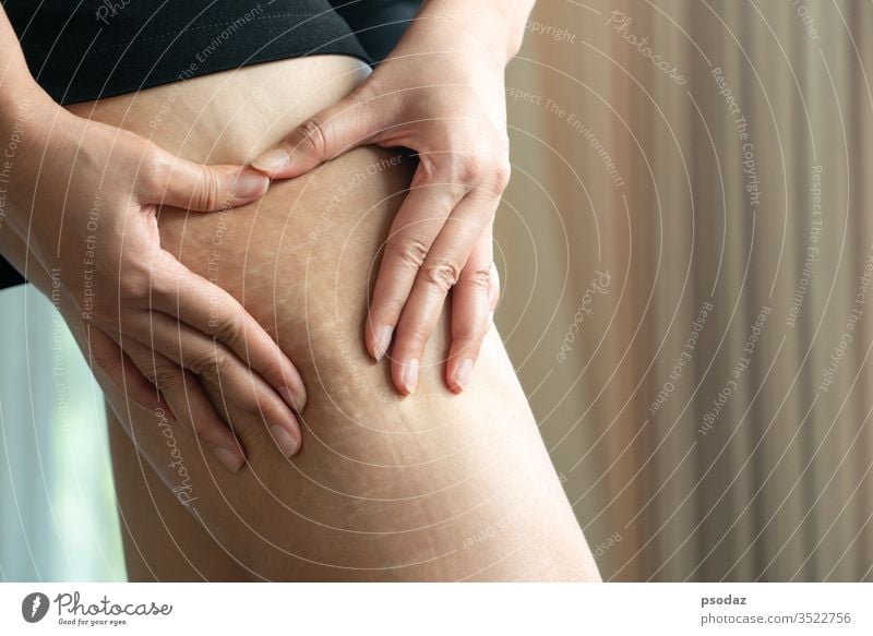 Weibliche Hand hält Fettzellulitis und Dehnungsstreifen am Bein zu Hause, Diät-Stil-Konzept für Frauen Erwachsener Hintergrund schön Schönheit groß Körper Pause
