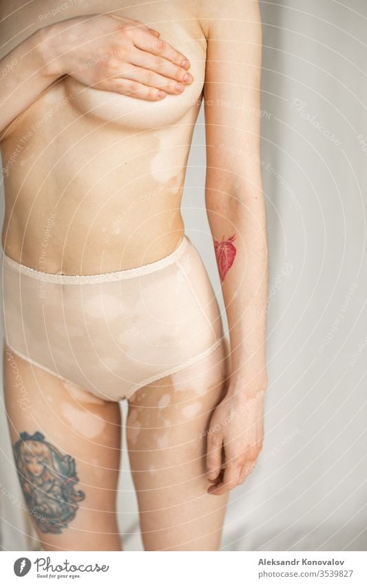 Junge Frau mit blasser Haut und Vitiligo steht auf Stoffhintergrund im natürlichen Licht in transparenter Unterwäsche und hält ihre Brust Körper Schönheit