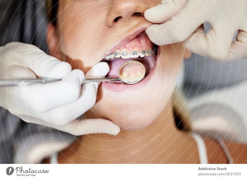 Anonymer Zahnarzt prüft Zähne des Patienten Frauen geduldig untersuchen Klinik Spiegel Klammer Handschuh Mund geöffnet Arbeit professionell prüfen Zeitgenosse