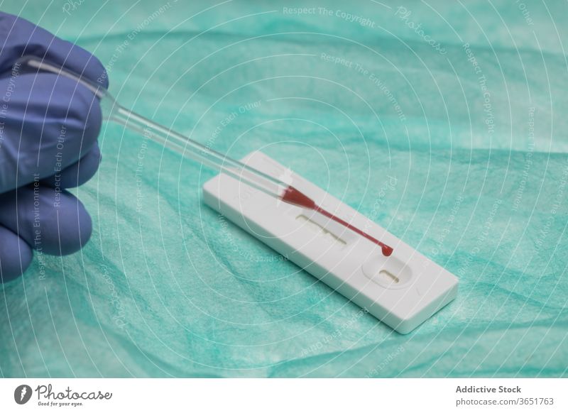 Pflanzenarzt mit Expressblutprobe im Krankenhaus Blut Prüfung reißend Arzt Coronavirus Bund 19 Sanitäter Probe Tropfen Tröpfchen Pipette Seuche Klinik Tisch