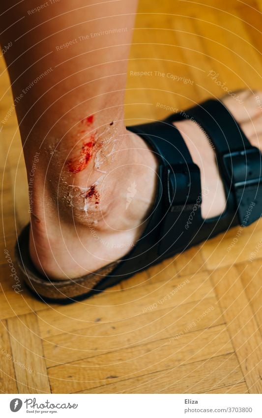 Fotografia do Stock: Verletzte Bein mit Schürfwunde