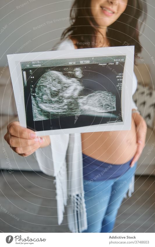 Anonyme schwangere Frau zeigt ein Ultraschallbild Scan Umarmen Magen Zärtlichkeit Mutterschaft Elternschaft Geburt Bonden Prüfung neugeboren planen berühren