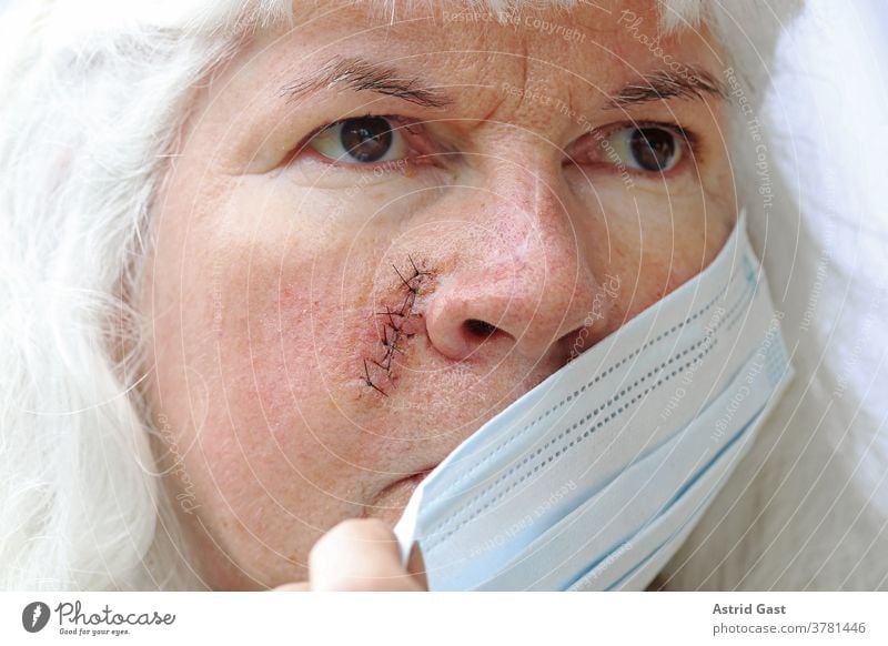 Maskenpflicht bei Verletzungen und Operationen gesicht haut frau operation narben naht fäden maske maskenpflicht corona covid 19 op-maske sicherheit virus