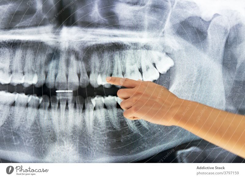 Ethnischer weiblicher Zahnarzt im medizinischen Raum mit Röntgenstrahlen Röntgenbild dental Klinik Arzt Frau Zahnmedizin Zähne geduldig Kiefer Information