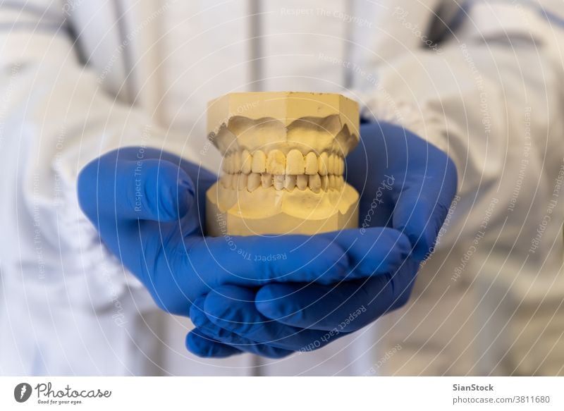 Zahnarzthände halten Zahnmodell, Prothese Model Zähne dental Kiefer Mund Zahnersatz weiß Uniform. mündlich Gesundheit Hygiene medizinisch Zahnmedizin Pflege