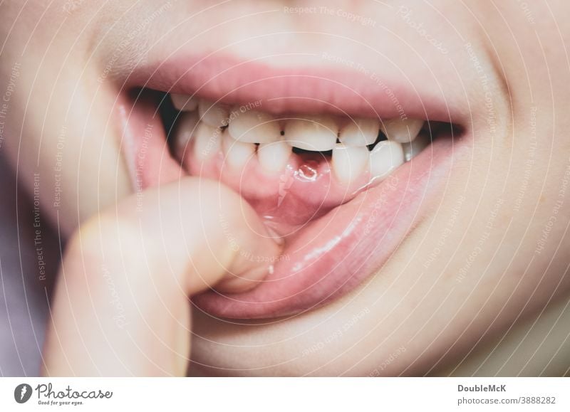 Mädchen zeigt Zahnlücke, erster Milchzahn ist rausgefallen Milchzähne Kind Kindheit Zähne Mund Farbfoto Lippen 3-8 Jahre Kopf Gesicht Mensch Fröhlichkeit Glück