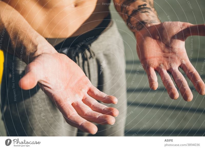 Hände mit Hornhaut eines jungen Sportlers der Gymnastik callus callosity calisthenics Härte Magnesium Pulver Kreide Athlet Mann Muskeln Stärke Kunstturnen