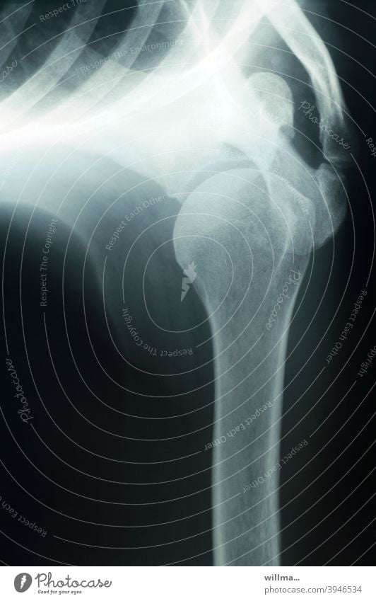 Röntgenbild Schultergelenk Gelenk Radiologie Diagnostik Technik & Technologie Gesundheitswesen Skelett Knochen Röntgenstrahlung