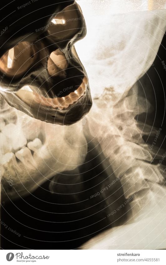 Begegnung - Röntgenbild von Schädel und Halswirbelsäule trifft auf einen menschlichen Schädel Knochen Mensch Skelett Wirbelsäule Medizin Sterblichkeit Kopf