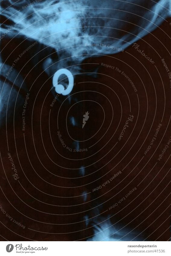 uups, mein ohrring... Piercing Röntgenbild Strahlung Wirbelsäule Wissenschaften Ohrringe Kopf Radiologie