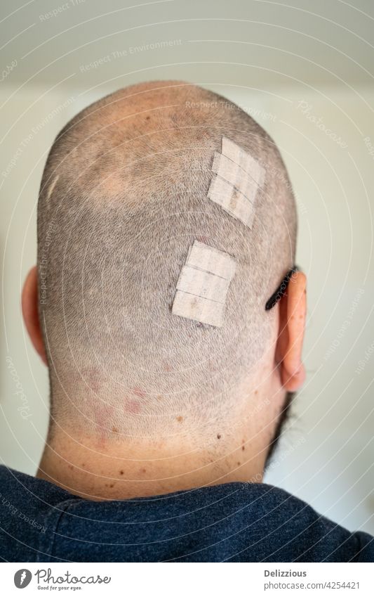 Ein Mann mit einer mit Pflaster bedeckten Wunde am Hinterkopf, senkrecht Wunden Rücken Kopf männlich Brille weiß Kaukasier verwundet wehtun wiederherstellen