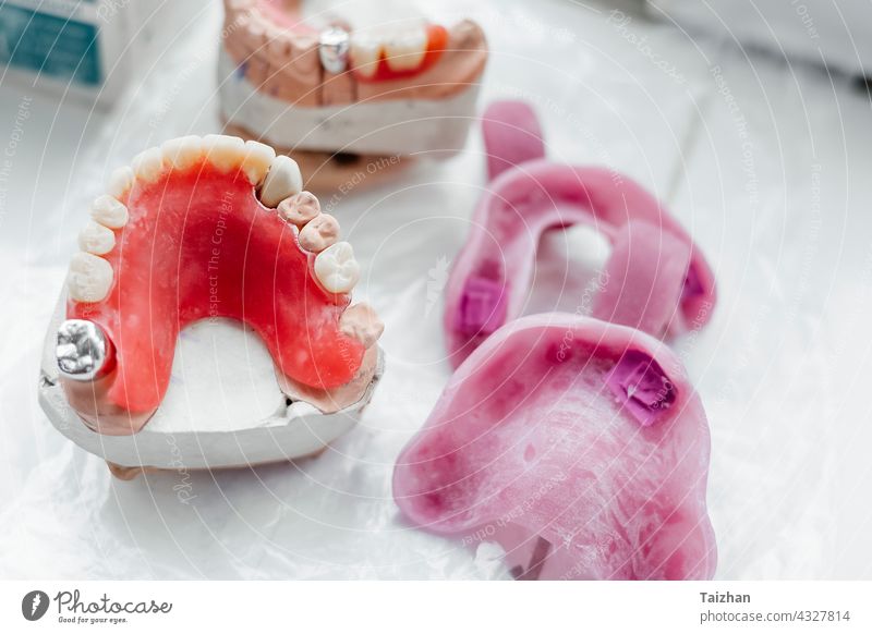 dentale Gipsmodelle des Oberkiefers, zahnmedizinisches Konzept Zahn Zahnarzt Zahnmedizin Labor Medizin Zahnersatz verputzen Prothesen Gerät menschlich Model