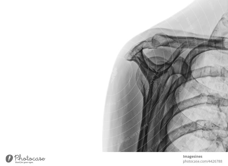 Röntgenbild eines weiblichen gesunden Körpers. Röntgenbild der weiblichen Schulter auf weissem Hintergrund isoliert. Erwachsene Anatomie Arm Bizeps Biologie