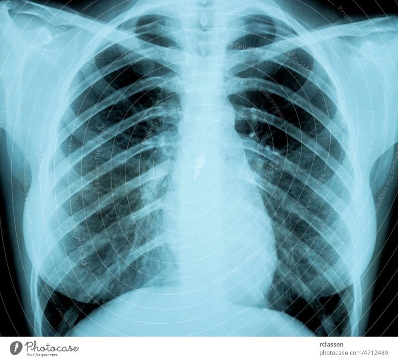 Röntgenbild der weiblichen Brust für eine medizinische Diagnose x röntgen Zutritt Röntgenaufnahme Anatomie Arzt Medizin Chirurgie Durchsichtigkeit Körper