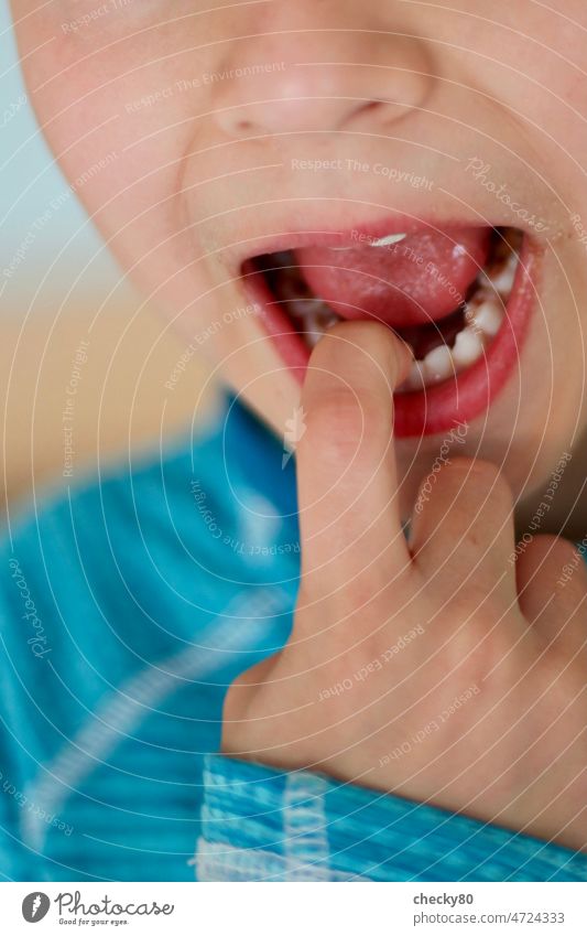 Kinderzähne Zahnarzt Wackelzahn Junge Mund Zunge wackeln Karies Zähne putzen Zähne zeigen Finger