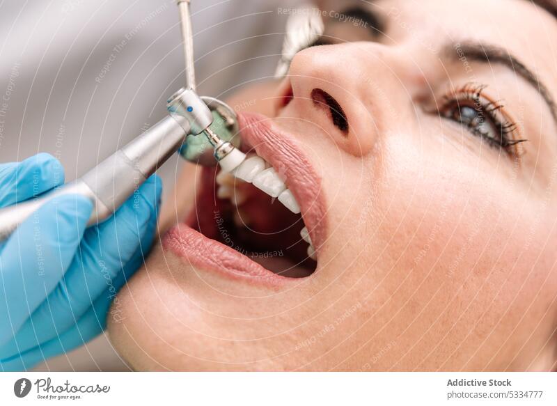 Zahnarzt bei der Behandlung der Zähne eines Patienten geduldig dental Leckerbissen Mund Arzt Verfahren Stomatologie Frau Gerät Instrument Werkzeug Klinik