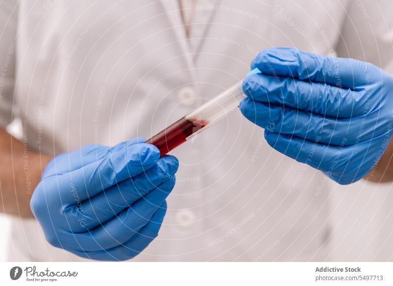 Crop-Arzt hält Blutprobenröhrchen im Labor Person Prüfung Reagenzglas Medizin medizinisch Probe Wissenschaft Hand Handschuh Zwischenablage Spezialist Analyse