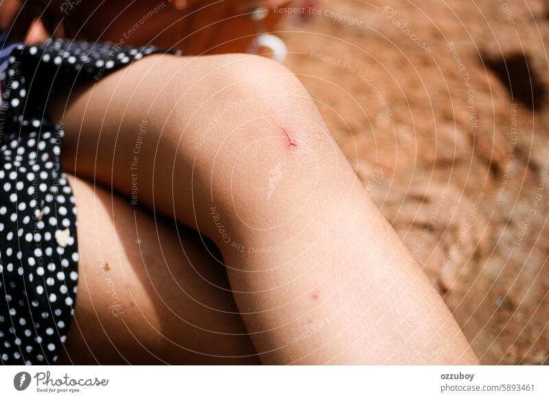 Gerissene Haut am Knie des Kindes. Aus einem Kratzer am Bein tritt ein wenig Blut aus. Unfall Unterstützung asiatisch Hintergrund blutend Körper blaue Flecken
