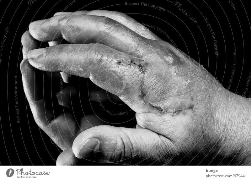 labor vulnerat Handrücken Finger Zeigefinger Daumen Mittelfinger Ringfinger Fingernagel kaputt Wunde Kruste Reflexion & Spiegelung Handwerk