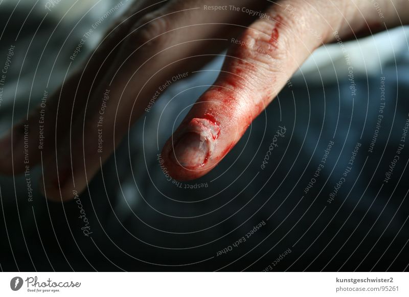 ende vom nagelbett... Finger Unfall Hand Nagel rot Wunde Mann Blut Schmerz