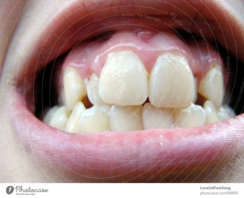 lovely teeth rosa gelb Zahnarzt Vertrauen mouth lips confidence anger gums crooked face tartar dentures skin